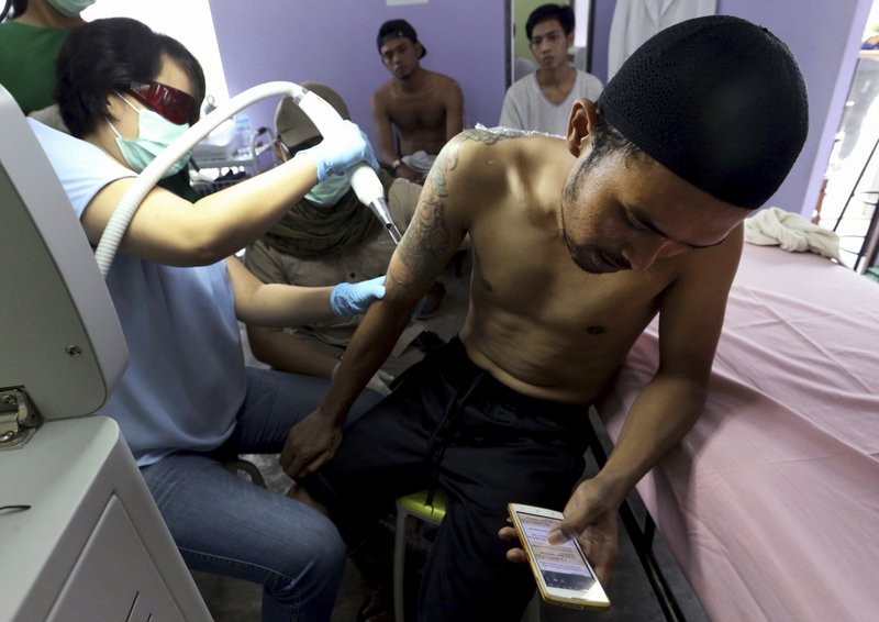 Indonesia Clinic Gives Relief to Muslims with Tattoo Regrets